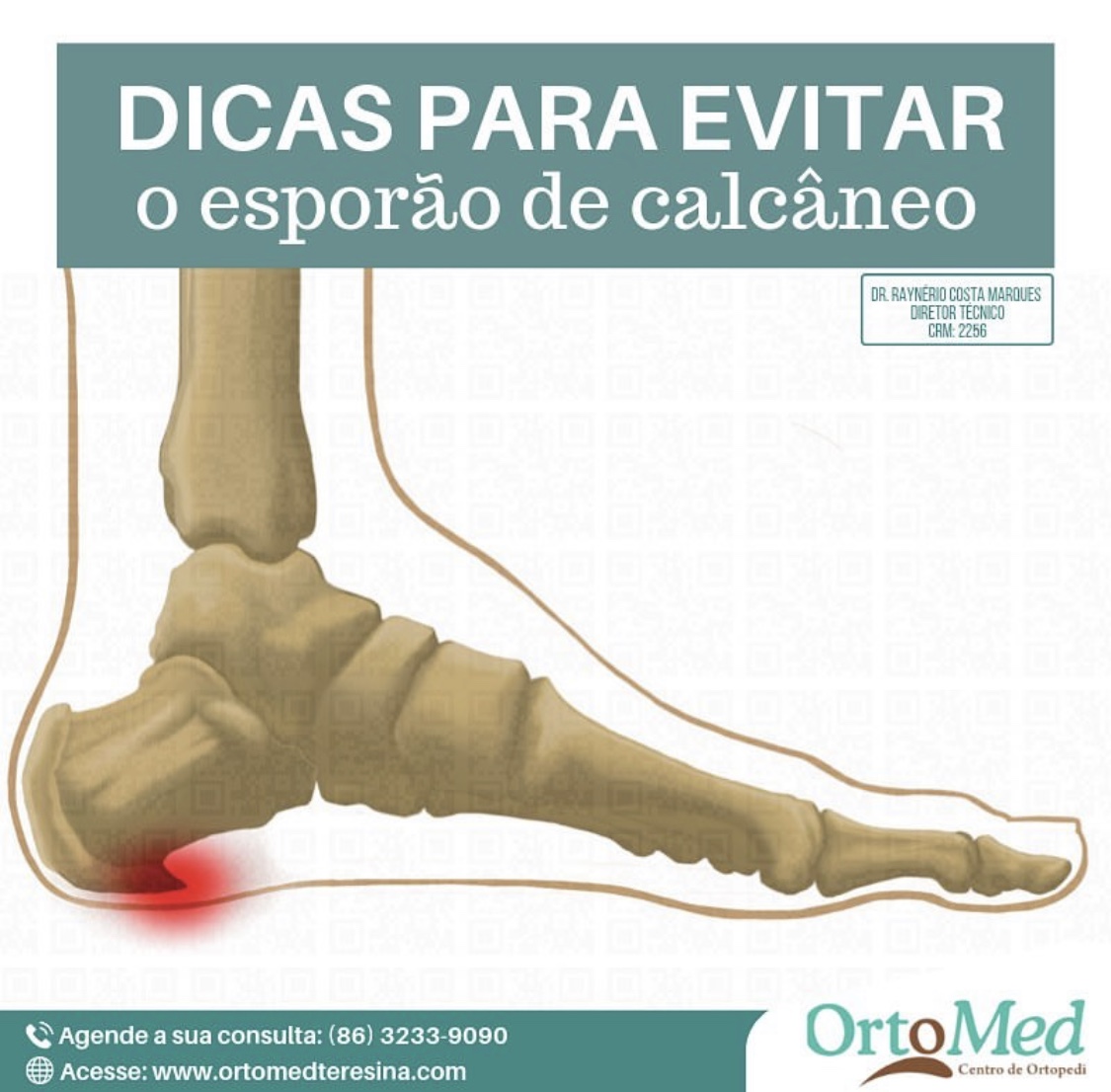 Problema é um dos mais comuns em consultório ortopédico