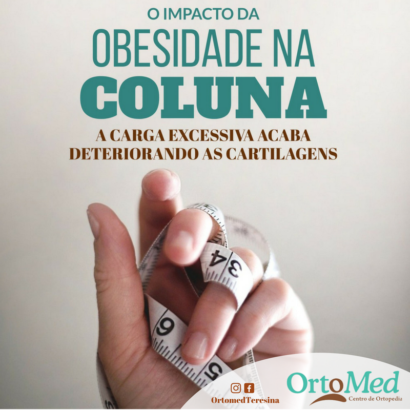 Obesidade afeta a coluna e as suas cartilagens